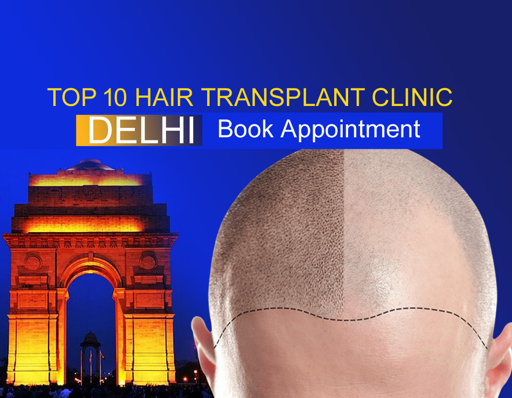 Hair Transplant Clinic in Delhi