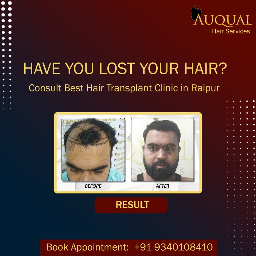 Hair Treatment Doctors in Raipur  View Cost Book Appointment Consult  Online