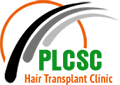 PLCSC hair transplant clinic