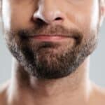 Beard transplant in birmingham