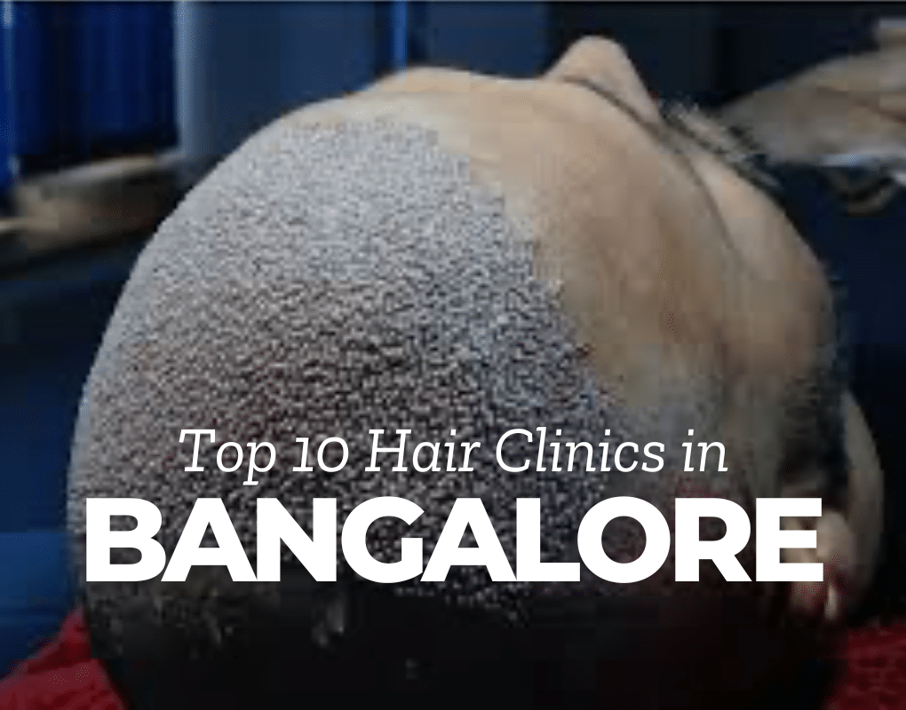 top 10 hair transplant clinics in Bangalore